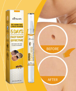 Alternative view of Ximonth Keyu Liquid Pen Clean Meat Granules Flat Especially Repair Skin Improve Skin Condition Fade Dark Spots