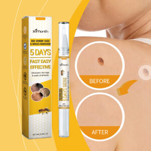 Alternative view of Ximonth Keyu Liquid Pen Clean Meat Granules Flat Especially Repair Skin Improve Skin Condition Fade Dark Spots