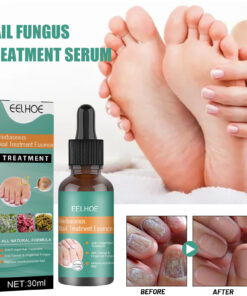 Alternative view of EELHOE Herbaceous Nail Relief Essence, Hand And Foot Nail Soft Thickening Brightening Nail And Bump Nail Care Solution