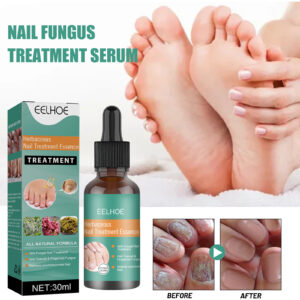 Alternative view of EELHOE Herbaceous Nail Relief Essence, Hand And Foot Nail Soft Thickening Brightening Nail And Bump Nail Care Solution