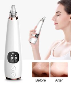New electric blackhead removal and pore cleaning for blackheads