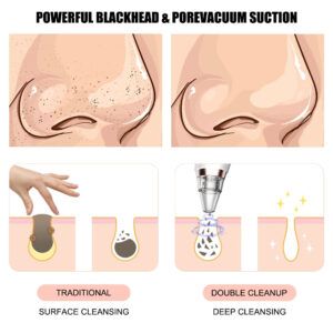 Alternative view of New electric blackhead removal and pore cleaning for blackheads