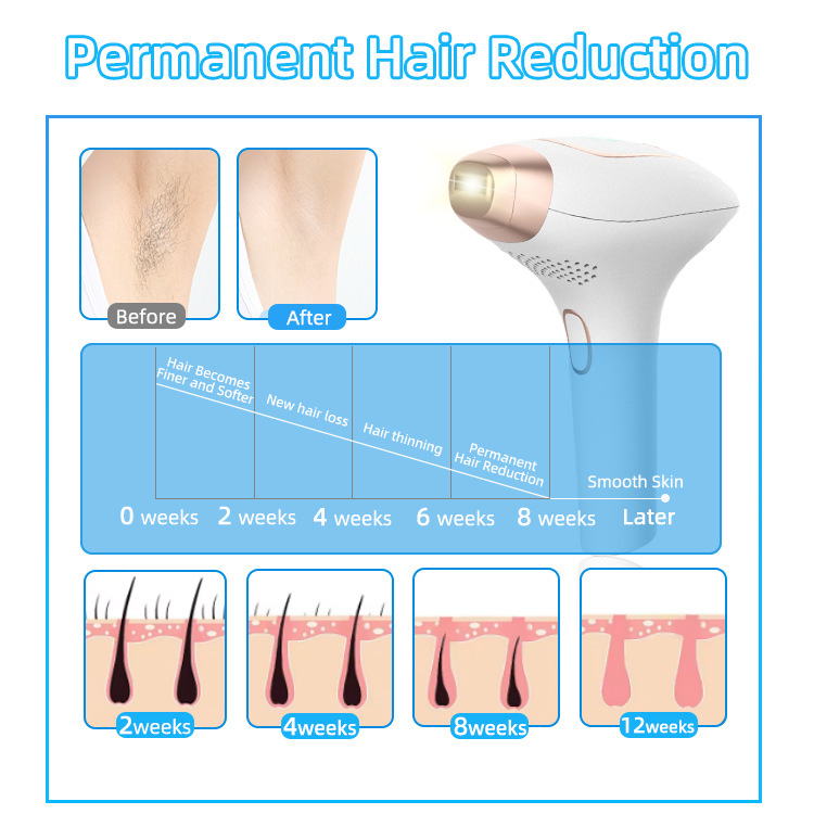 Handheld freezing point hair removal device, replaceable head IPL strong pulse portable whole body painless hair removal device - Image 3