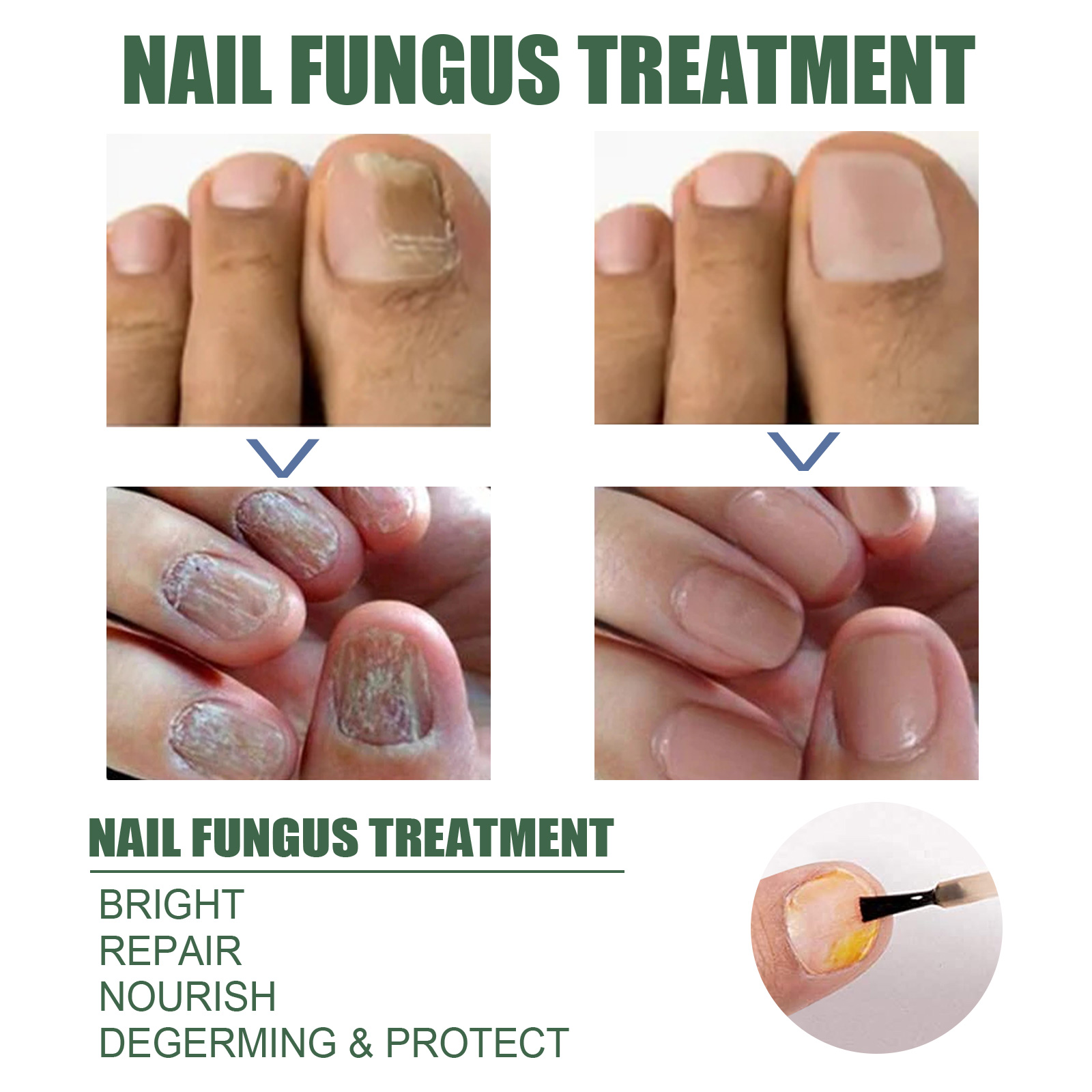 EELHOE Nail Care Liquid (30ml) Gentle Cleaning, Hydrating And Moisturizing Liquid For Thick And Soft Nails On The Surface Of Hands And Feet - Image 4