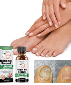 Alternative view of EELHOE Gray Nail Repair Remove Gray Nail Nourishing Lotion, Brightening Soft Nails Moisturizing Nail Care Solution For Hands, Feet And Nails