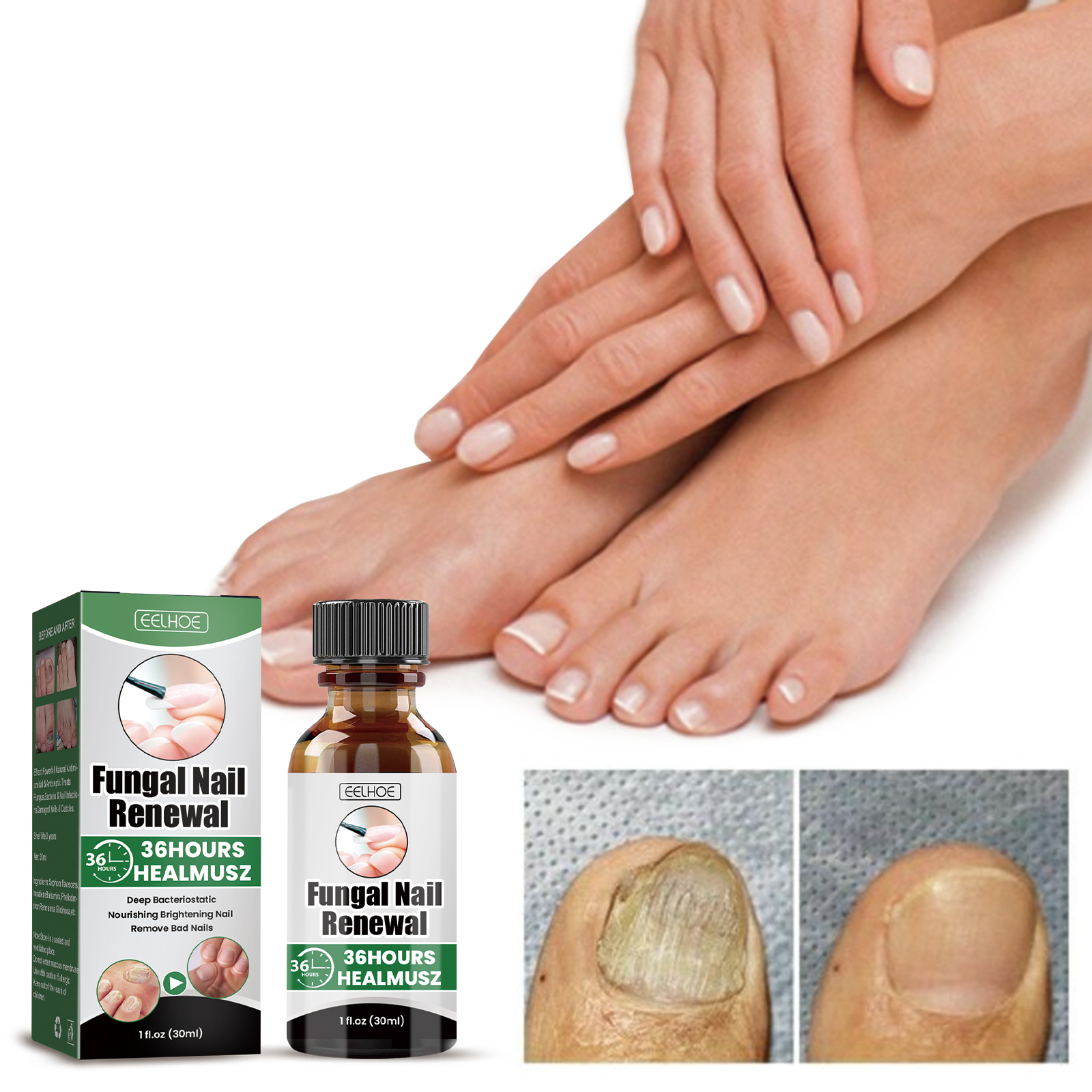 EELHOE Gray Nail Repair Remove Gray Nail Nourishing Lotion, Brightening Soft Nails Moisturizing Nail Care Solution For Hands, Feet And Nails - Image 2