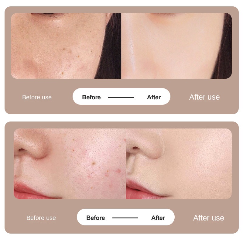 LCD dot mark pen home dot mark scanning pen laser beauty mole scanner - Image 3