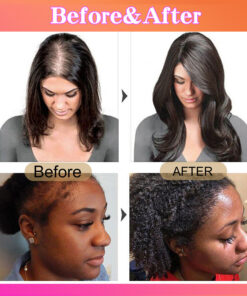 Alternative view of Batana Oil for Hair Growth Hair Conditioner Moisturizing and Repairing