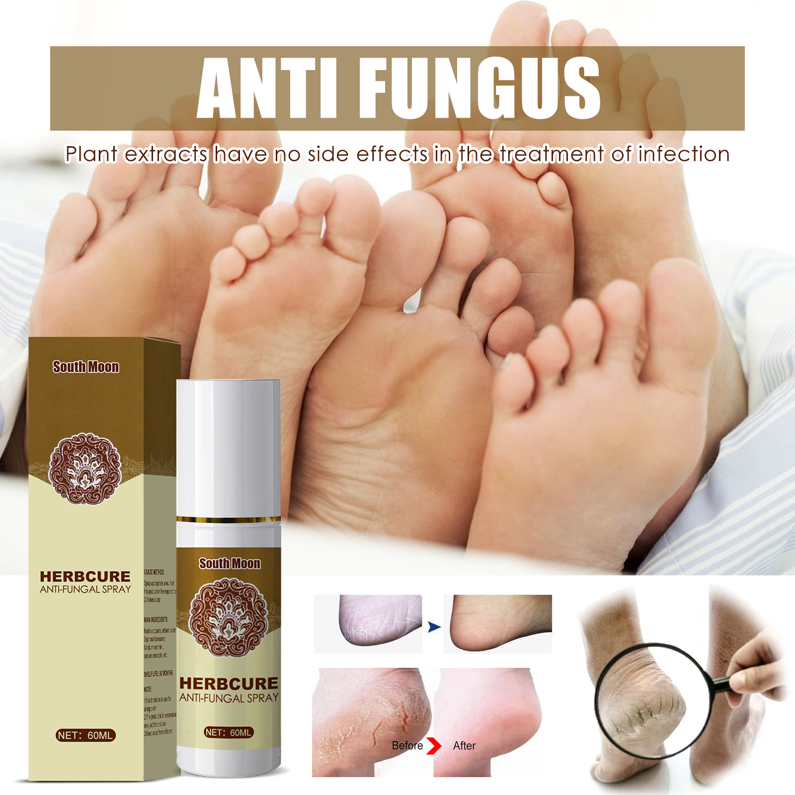 South Moon Herbal Foot Spray Moisturizes And Hydrates Foot Skin And Prevents Dry And Cracked Skin - Image 3