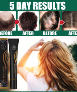 Alternative view of EELHOE Ball Massage Thickening Long Hair Lotion, Thick Thin Hair Anti-Breaking Hair Nourishing Hair Rolling Bead Massage Treatment