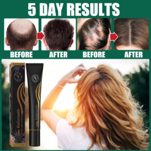 Alternative view of EELHOE Ball Massage Thickening Long Hair Lotion, Thick Thin Hair Anti-Breaking Hair Nourishing Hair Rolling Bead Massage Treatment