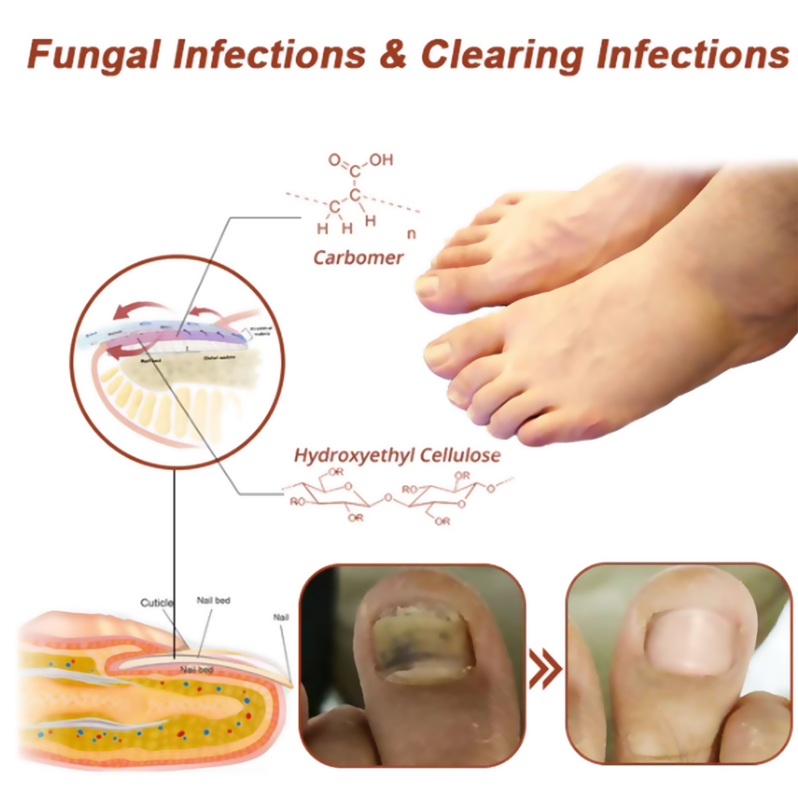 South Moon Nail Care Phototherapy Device, Repair Hands And Feet Gray Nails Yellow Ingrown Nail Soft Nail Care - Image 3