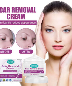 Alternative view of OUHOE Skin Care Cream Gently Nourishes And Lubricates Improving Skin Daily Care Facial Body Care Cream